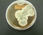 Surge in syphilis cases leads some providers to ration penicillin