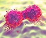 Bioactive glasses with gallium show promise for bone cancer treatment