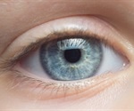 NYU Langone Health performs the world's first whole-eye and partial-face transplant for military veteran