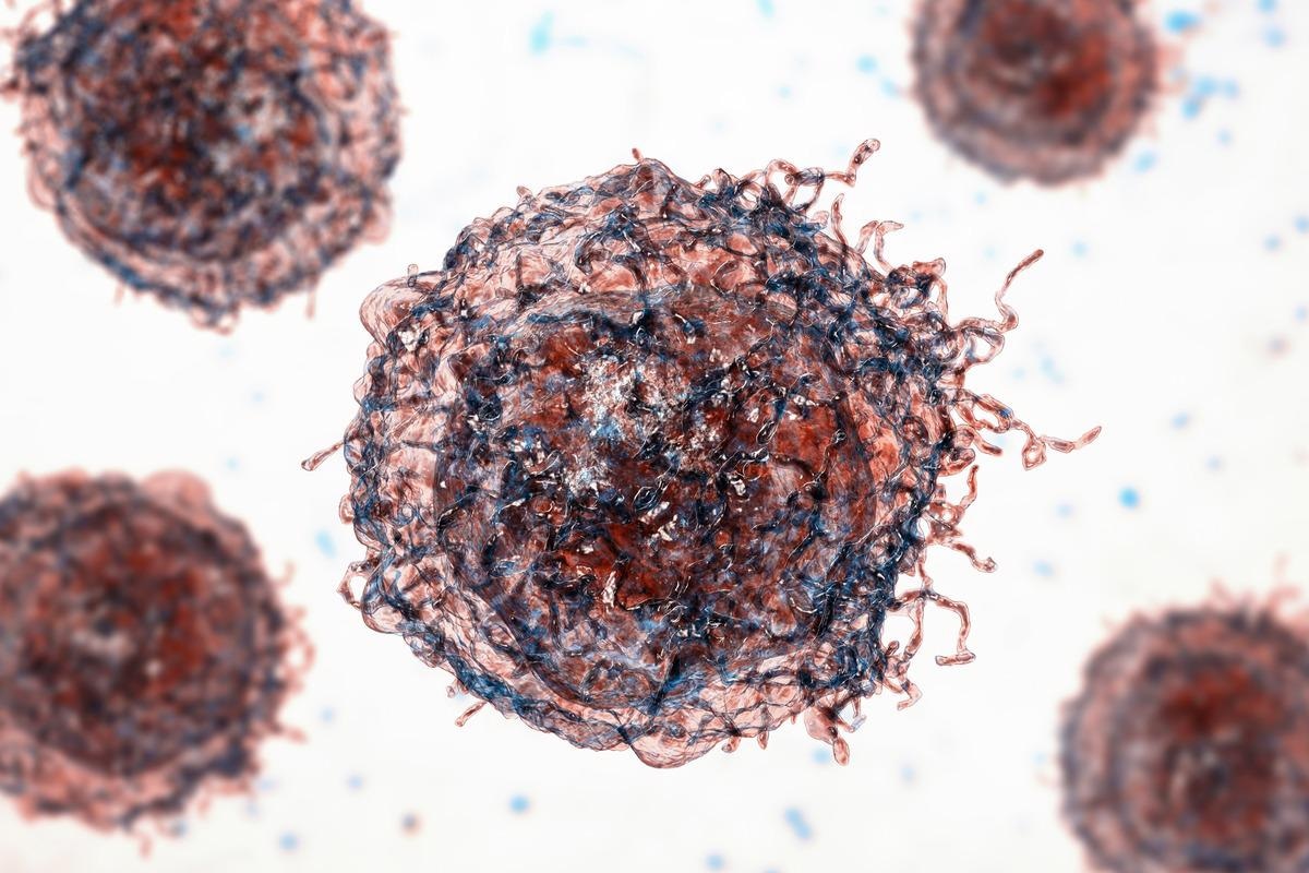 Malignant cells. Image Credit: Kateryna Kon/Shutterstock